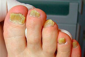 Nail trunk