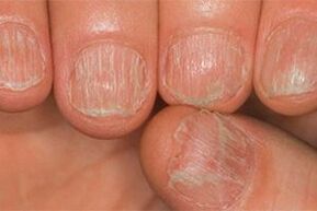 The lesion of fungi
