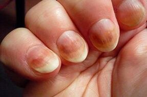 nail trunk