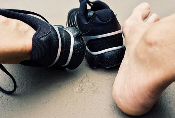Reasons for the appearance of the legs of the legs