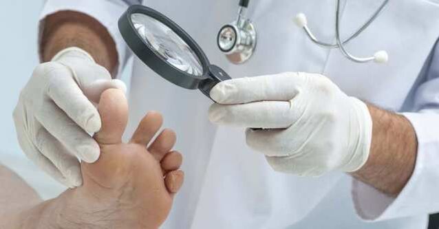 Examination of the feet for fungal infection