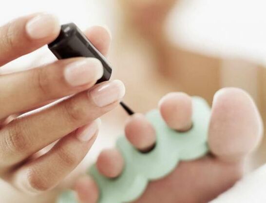 treating nails with varnish for fungal infection