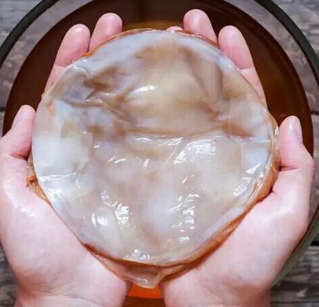 toenail fungus kombucha
